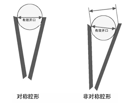 顎破腔型